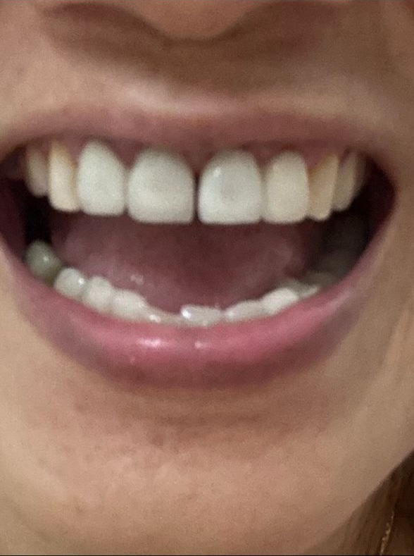 Before